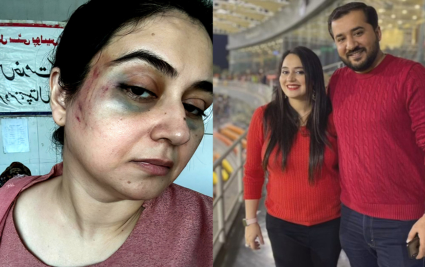 Court approves settlement in Ayesha Jahanzeb’s assault case following viral bruise photos