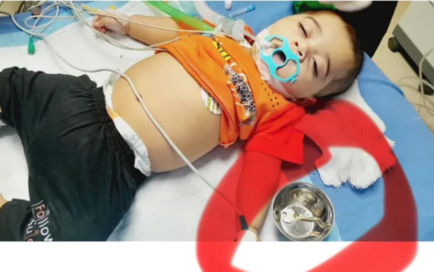 Doctors remove key from 5-year-old’s stomach