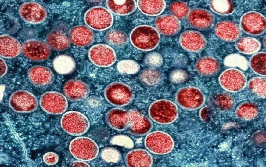 Pakistan reports fourth confirmed case of monkeypox