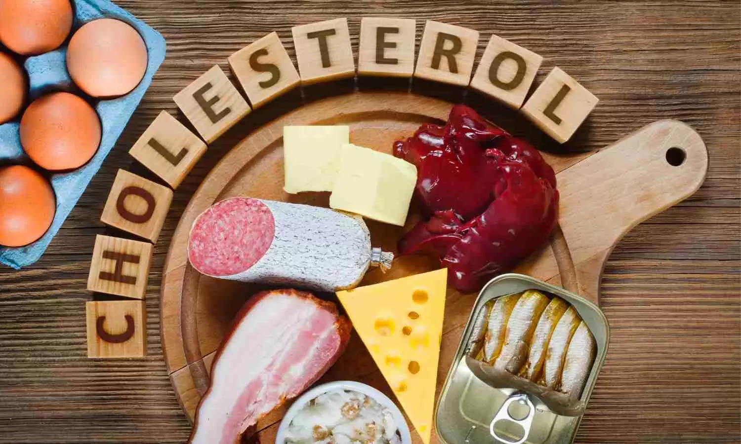 Fluctuating cholesterol levels linked to increased dementia risk: study